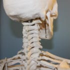 Cervical Lordosis